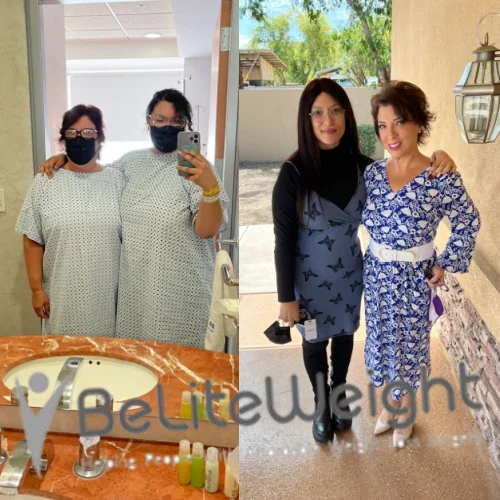 Weight Loss Surgery Before And After